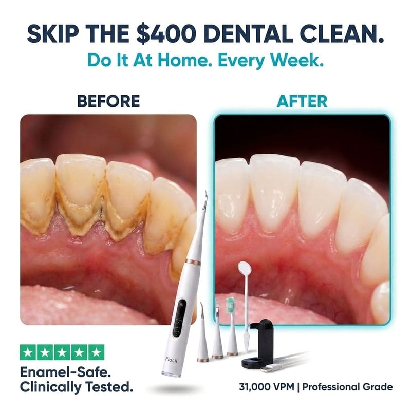 Tartar build-up on teeth - why brushing alone is not enough